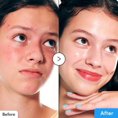EQQUALBERRY Hyaltoin Flooding Serum (30 mL)